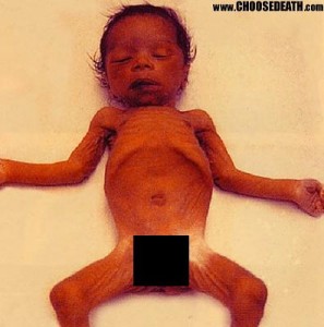 bayi-dehydaration