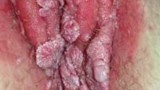 ketuat-kelamin-vulva