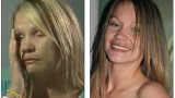 Photo Tina Nash Before and After Photo Tina Nash Before and After